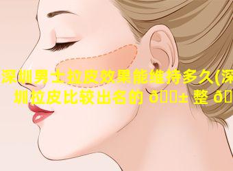 深圳男士拉皮效果能维持多久(深圳拉皮比较出名的 🐱 整 🐈 形医院)